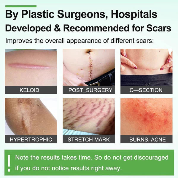 Silicone Gel Tape– Gentle Scar Reduction Therapy
