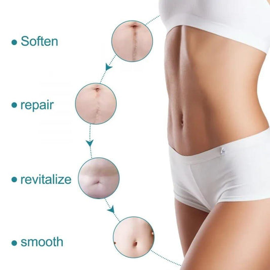 Silicone Gel Tape– Gentle Scar Reduction Therapy