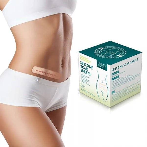 Silicone Gel Tape– Gentle Scar Reduction Therapy
