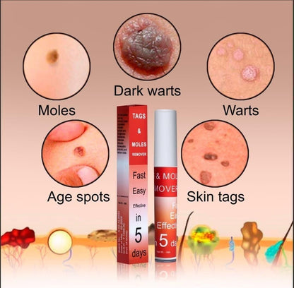 SkinClear™ – Painless Skin Tag & Mole Remover | Fast, Safe & Natural (Pack of 2)