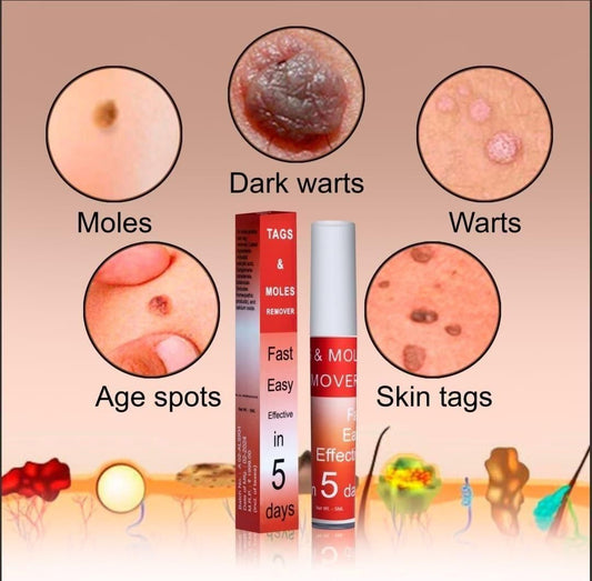 SkinClear™ – Painless Skin Tag & Mole Remover | Fast, Safe & Natural (Pack of 2)