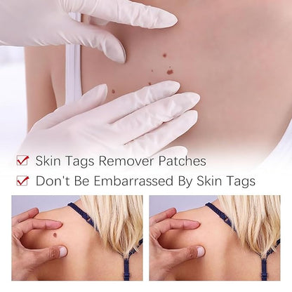 SkinClear™ – Painless Skin Tag & Mole Remover | Fast, Safe & Natural (Pack of 2)